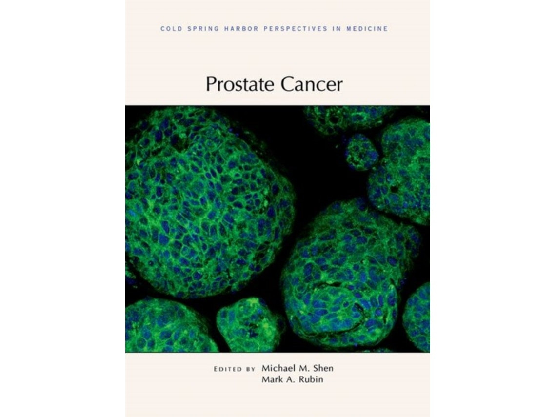 Prostate Cancer de Edited by Mark Rubin y Michael Shen (Inglés)
