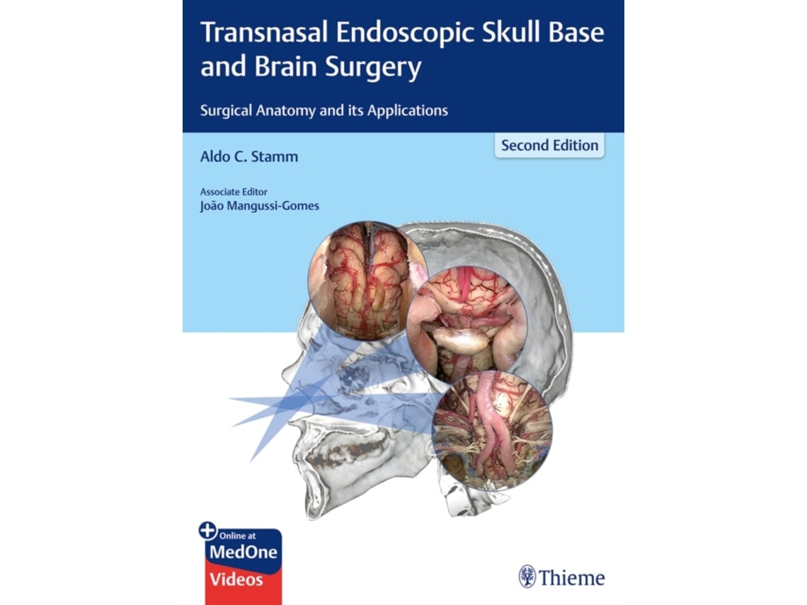 Transnasal Endoscopic Skull Base and Brain Surgery de Edited by Aldo C Stamm (Inglés)
