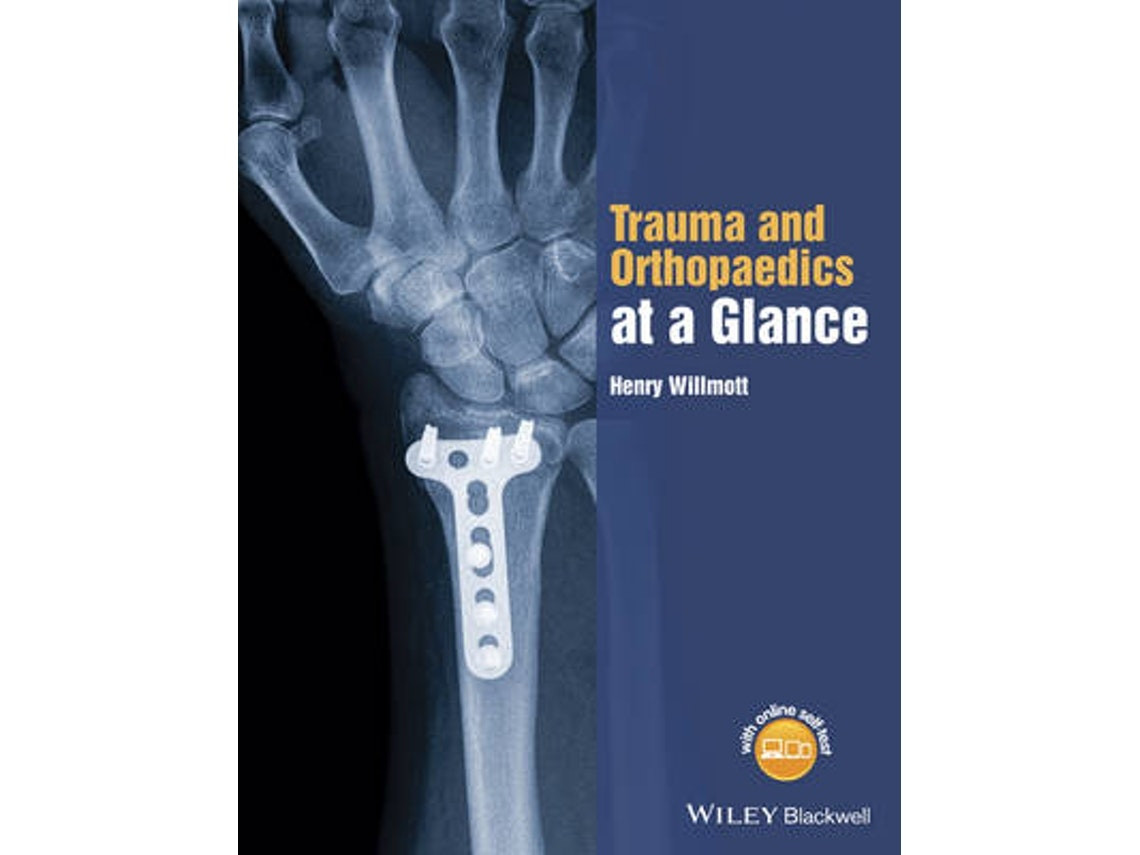 Trauma and Orthopaedics at a Glance de H Willmott (Inglés)