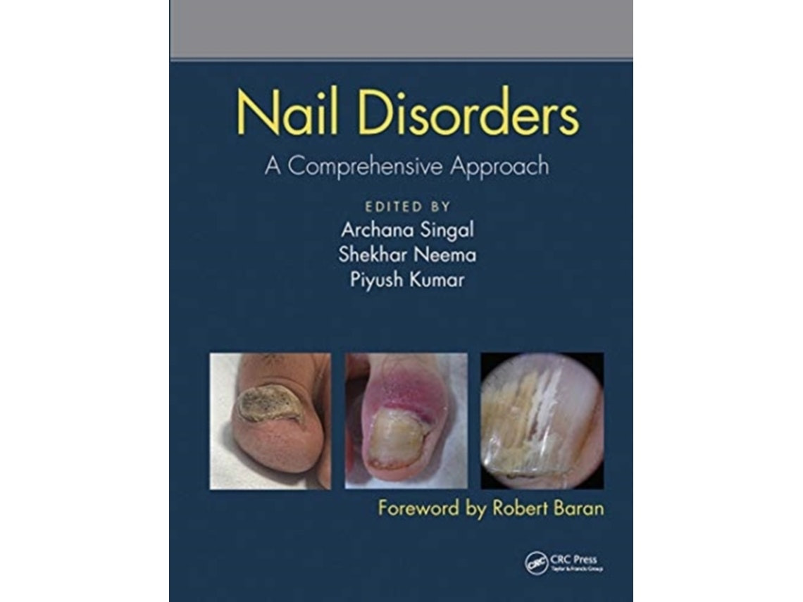 Nail Disorders de Edited by Archana Singal, Shekhar Neema, Piyush Kumar (Inglés)