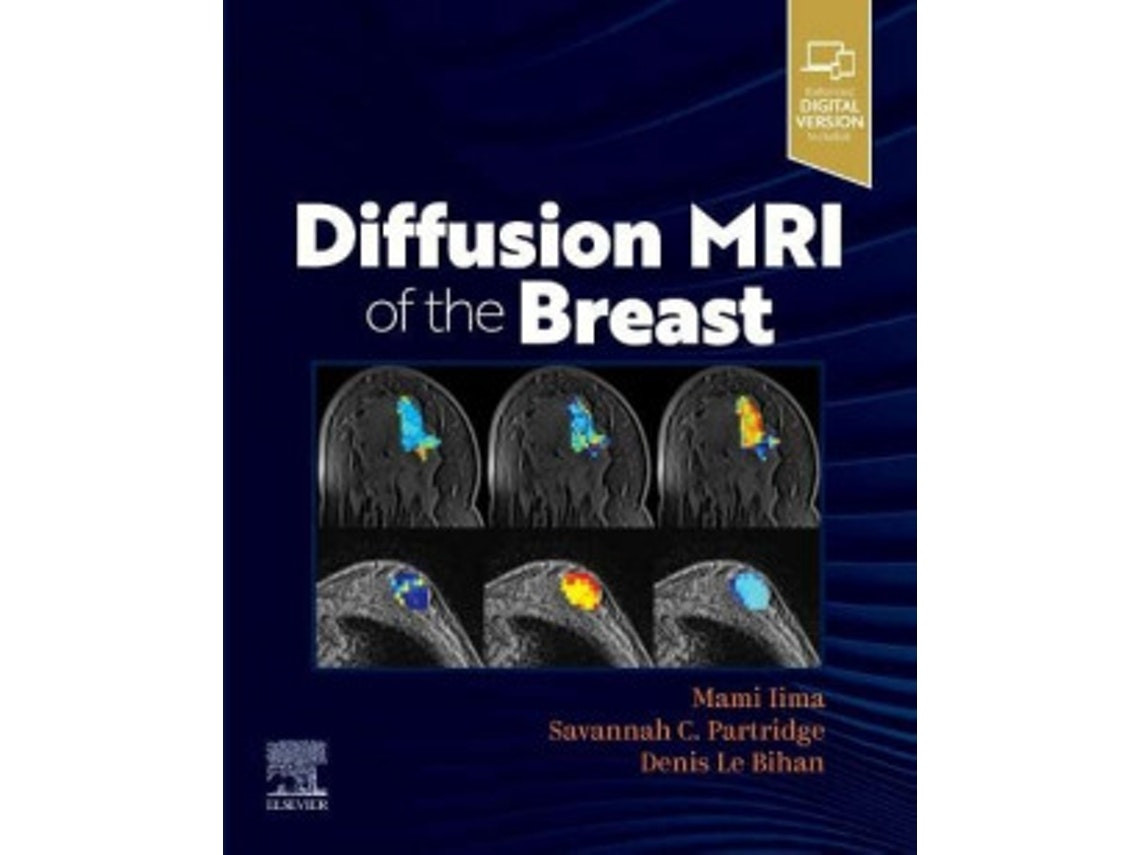 Diffusion MRI of the Breast de Iima, Partridge, Le Bihan (Inglés)