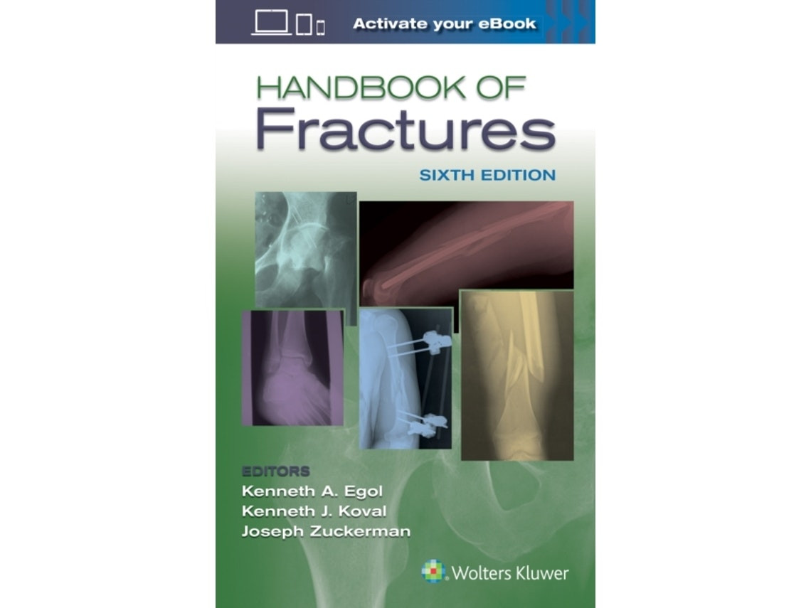 Handbook of Fractures by Egol (English)