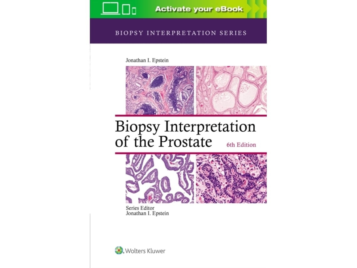 Biopsy Interpretation of the Prostate de Jonathan I. Epstein (Inglés)