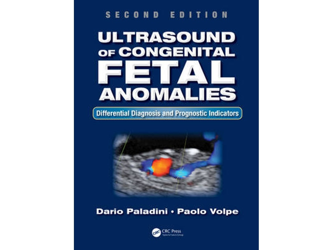 Ultrasound of congenital fetal anomalies de Dario Paladini y Paolo Volpe (Inglés)