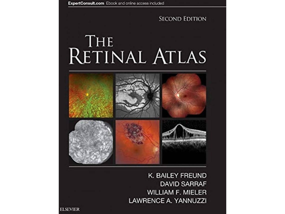 The Retinal Atlas de Varios Autores (Inglés)