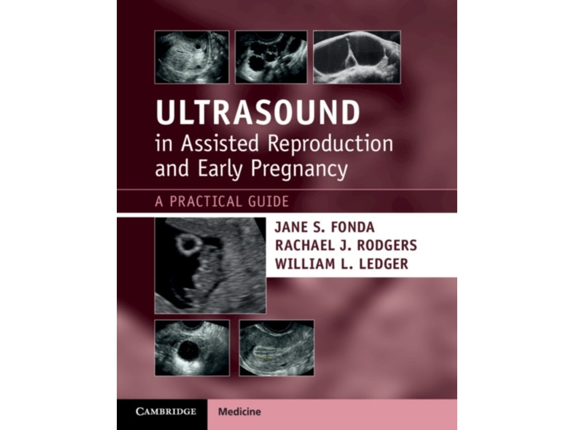 Ultrasound in Assisted Reproduction and Early Pregnancy by Jane S. Fonda and Rachael J. Rodgers (English)