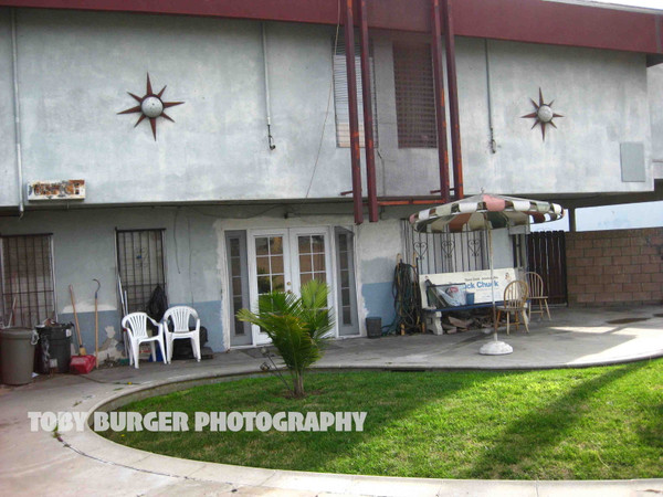 Sick Right Hand Kidney