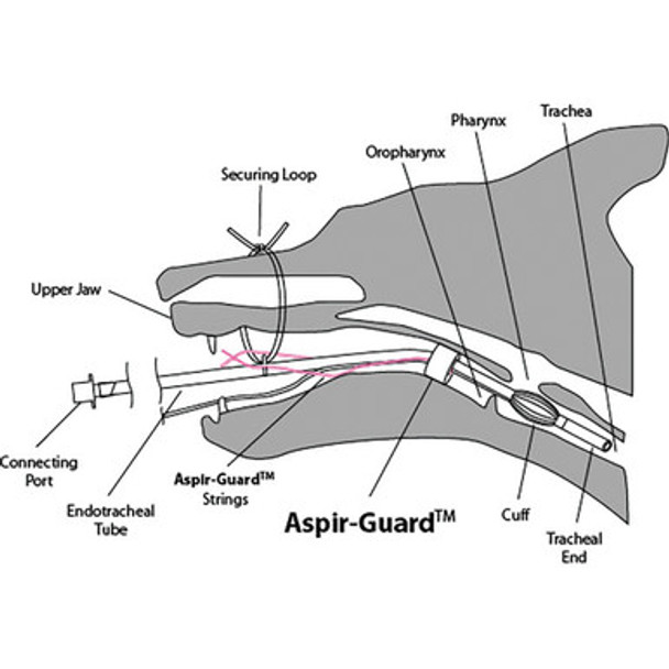 Aspir-Guard Moyen - 3 pièces