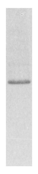 eIF4E is a mRNA Cap-binding protein