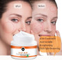 Kojic Acid Face Cream Anti Aging Wrinkle Beauty Dark Spot Removing Acne Skin Whitening Lightening Face Cream