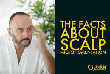 The Facts About Scalp Micropigmentation