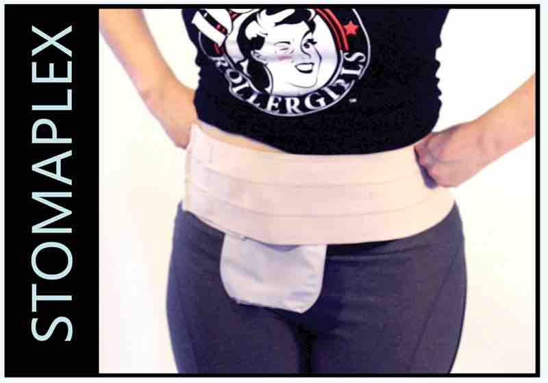 ostomy model girl bikini