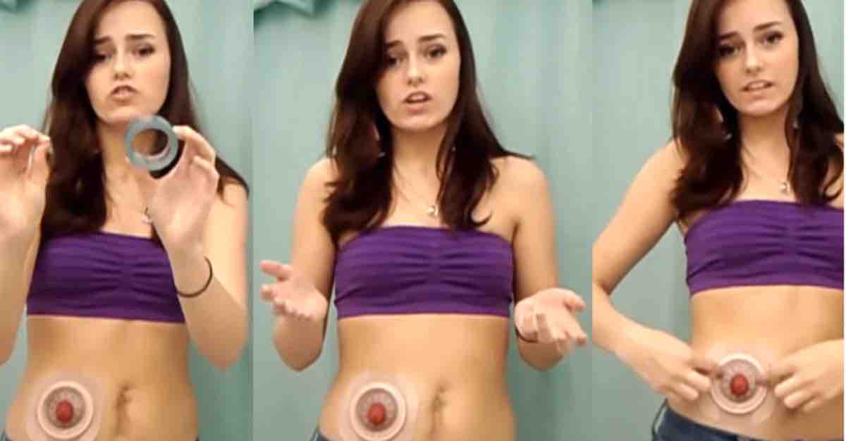 ostomy model girl bikini