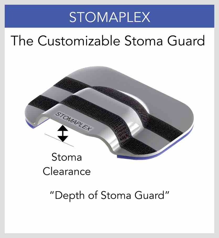 Stoma Guard, The Customizable Stoma Guard