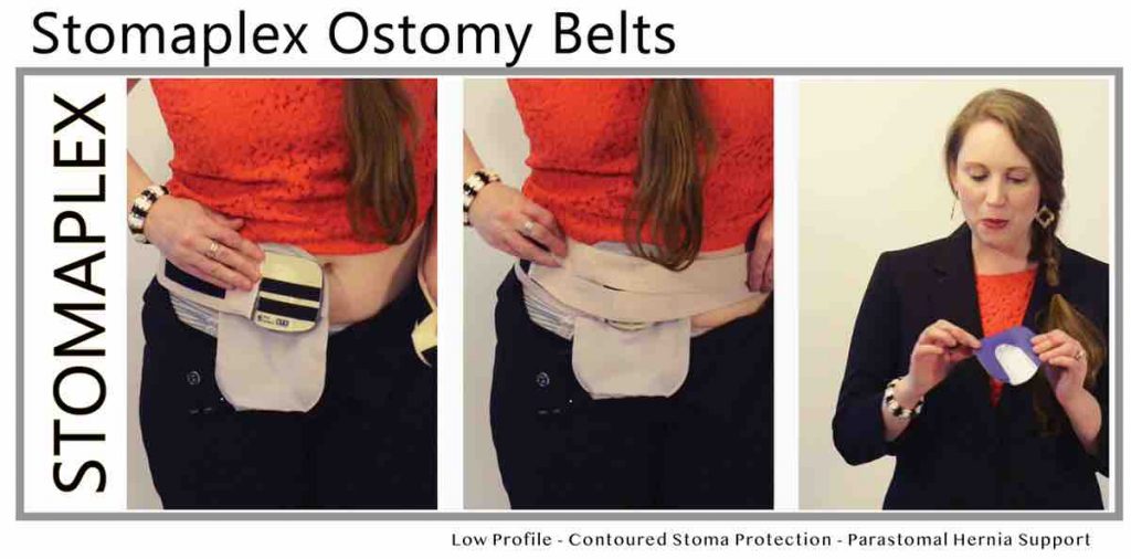 Stoma Guard Ostomy Belt Stomaplex