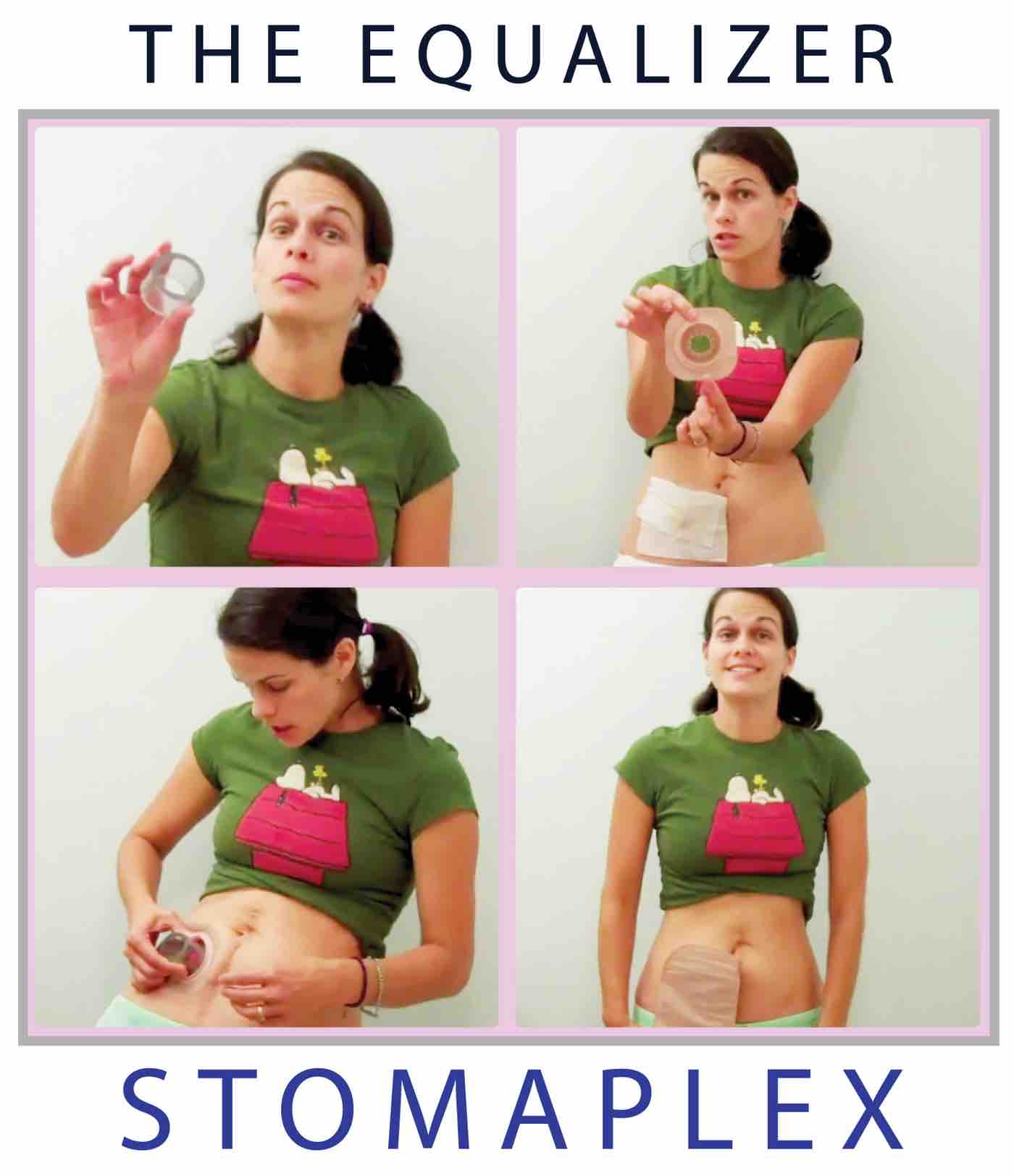 Stoma Guard Ostomy Belt Peace of Mind Stomaplex