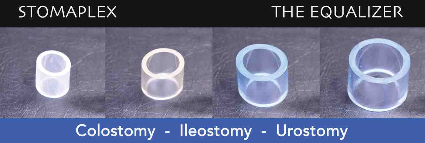 The Equalizer by Stomaplex helps to prevent ostomy leaks by improving the bond of the ostomy skin barrier to the skin. The Equalizer by Stomaplex helps to prevent ostomy leaks by improving the bond of the ostomy skin barrier to the skin.