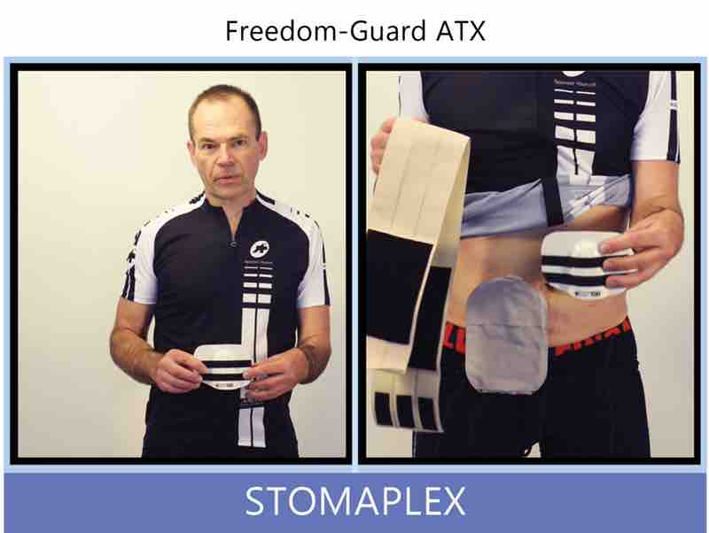 For sports and athletics, the Freedom-Guard ATX is recommended. This guard is the toughest and easiest to clean stoma guard offered by Stomaplex. The outside surface is an FDA approved rubber with two Velroc strips that are used to hold the ostomy belt to the face of the guard.
Here is the parastomal hernia ostomy belt. This belt is an option. The wider belt is helpful in preventing parastomal hernias on men who are concerned about developing a hernia. The belt is 4 and half inches wide the entire length of the belt. Ostomy belt, ostomy, stoma, protection, stoma protection, stoma guard, ostomy guard, ostomy protection products, ostomy shower, ostomy leak, stoma leak, ostomy hernia, stoma hernia, ostomy sports, stoma sports, hernia, stoma belt, ostomy leaks, stoma leaks, leaking barrier, leaking stoma, stoma pain, ostomy pain, stomal hernias, hernias, children stoma, pediatric armor, ostomy protection, stoma protection sale, ostomy products, ostomy discounts, ostomy product discounts, ostomy product sale, ostomy ultimate discount package, strong ostomy belt, strongest ostomy belt, stoma shield, stoma shields, stoma guards, stoma protection products, stoma guard belt, stoma protection for sports, stoma protector, stoma guard reviews, stoma protectors, ostomy shower apron, ileostomy, colostomy, stomaplex, ostomy belt swimming, ostomy clothing, ostomy leak protection, freedom guard, comfort guard, veterans ostomy, pediatric ostomy belts, pediatric stoma, pediatric stoma protection, stoma protection for children, children ostomy belts
