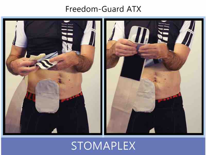 Notice how wide the belt is. The parastomal hernia belt os 4.5 inches wide the entire length of the belt. Also notice the large area to adjust the tension of the belt. The belt will wrap around the belly and apply pressure to the area around the stoma.
Attach the parastomal hernia belt to the stoma guard by rubbing the end of the belt to the face of the guard. This is the first step that you'll need to do after you wash and clean the belt. The soft fuzzy side of the belt secures the guard. This belt is recommended for soccer, football and other contact sports with an ostomy. Ostomy belt, ostomy, stoma, protection, stoma protection, stoma guard, ostomy guard, ostomy protection products, ostomy shower, ostomy leak, stoma leak, ostomy hernia, stoma hernia, ostomy sports, stoma sports, hernia, stoma belt, ostomy leaks, stoma leaks, leaking barrier, leaking stoma, stoma pain, ostomy pain, stomal hernias, hernias, children stoma, pediatric armor, ostomy protection, stoma protection sale, ostomy products, ostomy discounts, ostomy product discounts, ostomy product sale, ostomy ultimate discount package, strong ostomy belt, strongest ostomy belt, stoma shield, stoma shields, stoma guards, stoma protection products, stoma guard belt, stoma protection for sports, stoma protector, stoma guard reviews, stoma protectors, ostomy shower apron, ileostomy, colostomy, stomaplex, ostomy belt swimming, ostomy clothing, ostomy leak protection, freedom guard, comfort guard, veterans ostomy, pediatric ostomy belts, pediatric stoma, pediatric stoma protection, stoma protection for children, children ostomy belts