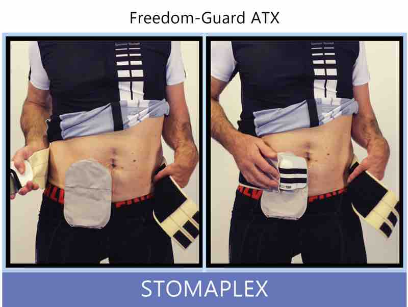 He brings the belt around his back to the front and seeing where the ostomy stoma is located so that the guard will cover and protect the ileostomy from damage that could occur while he is out bicycling. The stoma guard is essential when participating in ostomy sports. Bob is holding the stoma guard in his right hand. The ostomy belt is now attached to the outside third of the guard face. Inside the guard you can see the black plastic that makes up the integrity of the stoma guard.
Bob places the stoma guard over the stoma pouch covering and protecting the ostomy. He is holding the guard with his right hand as he bring the belt forward to the guard. Ostomy belt, ostomy, stoma, protection, stoma protection, stoma guard, ostomy guard, ostomy protection products, ostomy shower, ostomy leak, stoma leak, ostomy hernia, stoma hernia, ostomy sports, stoma sports, hernia, stoma belt, ostomy leaks, stoma leaks, leaking barrier, leaking stoma, stoma pain, ostomy pain, stomal hernias, hernias, children stoma, pediatric armor, ostomy protection, stoma protection sale, ostomy products, ostomy discounts, ostomy product discounts, ostomy product sale, ostomy ultimate discount package, strong ostomy belt, strongest ostomy belt, stoma shield, stoma shields, stoma guards, stoma protection products, stoma guard belt, stoma protection for sports, stoma protector, stoma guard reviews, stoma protectors, ostomy shower apron, ileostomy, colostomy, stomaplex, ostomy belt swimming, ostomy clothing, ostomy leak protection, freedom guard, comfort guard, veterans ostomy, pediatric ostomy belts, pediatric stoma, pediatric stoma protection, stoma protection for children, children ostomy belts
