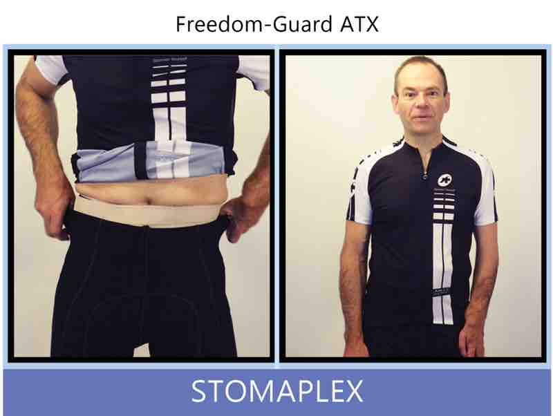 Pull up your underwear or bike shorts and snap the waistband over the stoma to know that you are protected. The super smooth profile will barely be noticeable beneath your bike shorts. Have confidence that your stoma will be safe from injury while you are wearing the parastomal hernia support belt.
Go out and enjoy life. Be safe, active and confident. Regain your strength by exercising safely after your ostomy surgury. The Stomaplex parastomal hernia support belt will help compress the area around the stoma and help prevent hernia from developing around and near the stoma of an urostomy, ileostomy, or colostomy. Ostomy belt, ostomy, stoma, protection, stoma protection, stoma guard, ostomy guard, ostomy protection products, ostomy shower, ostomy leak, stoma leak, ostomy hernia, stoma hernia, ostomy sports, stoma sports, hernia, stoma belt, ostomy leaks, stoma leaks, leaking barrier, leaking stoma, stoma pain, ostomy pain, stomal hernias, hernias, children stoma, pediatric armor, ostomy protection, stoma protection sale, ostomy products, ostomy discounts, ostomy product discounts, ostomy product sale, ostomy ultimate discount package, strong ostomy belt, strongest ostomy belt, stoma shield, stoma shields, stoma guards, stoma protection products, stoma guard belt, stoma protection for sports, stoma protector, stoma guard reviews, stoma protectors, ostomy shower apron, ileostomy, colostomy, stomaplex, ostomy belt swimming, ostomy clothing, ostomy leak protection, freedom guard, comfort guard, veterans ostomy, pediatric ostomy belts, pediatric stoma, pediatric stoma protection, stoma protection for children, children ostomy belts