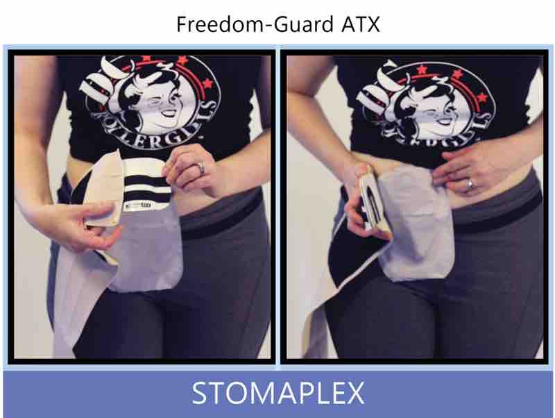 I'm so happy to share with you why I love the Stomaplex stoma guard. When I'm out being active playing sports with an ostomy, I feel 100% safe that my stoma is protected from contact with other athletes on the roller derby skating rink. The Stomaplex stoma guard has a shape that works with my body and needs. When I'm wearing the stoma guard under my shorts the shape of the Stomplex is undetectable. That is why I love the Stomaplex stoma guard. She likes to play hard when skating. Christy was looking for a stoma guard the would cover the stoma and not flex during impact. When using the Stomaplex ostomy belt designed to prevent parastomal hernias along with the stoma guard, she is ready to skate in the next roller deby bout. Christy is an athletic, young women with an ostomy. Her ileostomy is not slowing her down. She wanted to get back into skating for the DC Rollergirls but was concerned about getting hit on the stoma of her ileostomy.
With the parastomal hernia ostomy support belt attached, I start to bring the belt around to the back. The wider belt is going to help reduce the risk of developing a parastomal hernia by the pressure the belt is applying to the site around the ileostomy. I place the stoma guard over my ileostomy to get an idea how it is going to fit. The small guard size is perfect for the size of my stoma. If the guard was any larger it would interfere with my movement while skating in the next roller derby bout. Ostomy belt, ostomy, stoma, protection, stoma protection, stoma guard, ostomy guard, ostomy protection products, ostomy shower, ostomy leak, stoma leak, ostomy hernia, stoma hernia, ostomy sports, stoma sports, hernia, stoma belt, ostomy leaks, stoma leaks, leaking barrier, leaking stoma, stoma pain, ostomy pain, stomal hernias, hernias, children stoma, pediatric armor, ostomy protection, stoma protection sale, ostomy products, ostomy discounts, ostomy product discounts, ostomy product sale, ostomy ultimate discount package, strong ostomy belt, strongest ostomy belt, stoma shield, stoma shields, stoma guards, stoma protection products, stoma guard belt, stoma protection for sports, stoma protector, stoma guard reviews, stoma protectors, ostomy shower apron, ileostomy, colostomy, stomaplex, ostomy belt swimming, ostomy clothing, ostomy leak protection, freedom guard, comfort guard, veterans ostomy, pediatric ostomy belts, pediatric stoma, pediatric stoma protection, stoma protection for children, children ostomy belts