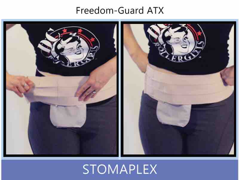 Attach the belt to the guard. This help keep the stoma guard in position when contact during sports happens. The belt will stretch and reshape itself to the contour of your hips and waist. The ostomy belt is wide and comfortable and will not roll or bind around the waist.
Feel how smooth the belt is over the stoma. Christly loves the way the belt fits smoothly over and around her belly even with an ostomy guard on protecting the stoma. She really needs ostomy protection because Christy skate for a roller derby team in Washington DC. Ostomy belt, ostomy, stoma, protection, stoma protection, stoma guard, ostomy guard, ostomy protection products, ostomy shower, ostomy leak, stoma leak, ostomy hernia, stoma hernia, ostomy sports, stoma sports, hernia, stoma belt, ostomy leaks, stoma leaks, leaking barrier, leaking stoma, stoma pain, ostomy pain, stomal hernias, hernias, children stoma, pediatric armor, ostomy protection, stoma protection sale, ostomy products, ostomy discounts, ostomy product discounts, ostomy product sale, ostomy ultimate discount package, strong ostomy belt, strongest ostomy belt, stoma shield, stoma shields, stoma guards, stoma protection products, stoma guard belt, stoma protection for sports, stoma protector, stoma guard reviews, stoma protectors, ostomy shower apron, ileostomy, colostomy, stomaplex, ostomy belt swimming, ostomy clothing, ostomy leak protection, freedom guard, comfort guard, veterans ostomy, pediatric ostomy belts, pediatric stoma, pediatric stoma protection, stoma protection for children, children ostomy belts