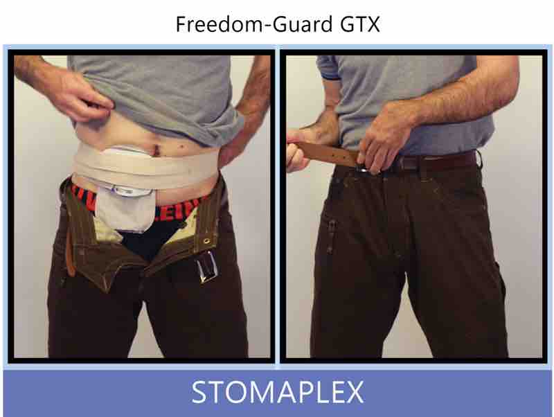 Finish putting the belt over the guard and adjust the tension of belt so that is comfortable. Notice the nice, smooth profile. The pressure from the protector over the ostomy will help secure the wafer to your skin. You may see a day or of increased wear time between ostomy changes.
Tighten the belt on your pants of your jeans over the stoma. There is no worry about the belt pressing on the stoma with the guard covering it. Here Bob is pulling his belt really tight to demostrate how the stoma guard is able to protect in extreme conditions. Ostomy belt, ostomy, stoma, protection, stoma protection, stoma guard, ostomy guard, ostomy protection products, ostomy shower, ostomy leak, stoma leak, ostomy hernia, stoma hernia, ostomy sports, stoma sports, hernia, stoma belt, ostomy leaks, stoma leaks, leaking barrier, leaking stoma, stoma pain, ostomy pain, stomal hernias, hernias, children stoma, pediatric armor, ostomy protection, stoma protection sale, ostomy products, ostomy discounts, ostomy product discounts, ostomy product sale, ostomy ultimate discount package, strong ostomy belt, strongest ostomy belt, stoma shield, stoma shields, stoma guards, stoma protection products, stoma guard belt, stoma protection for sports, stoma protector, stoma guard reviews, stoma protectors, ostomy shower apron, ileostomy, colostomy, stomaplex, ostomy belt swimming, ostomy clothing, ostomy leak protection, freedom guard, comfort guard, veterans ostomy, pediatric ostomy belts, pediatric stoma, pediatric stoma protection, stoma protection for children, children ostomy belts
