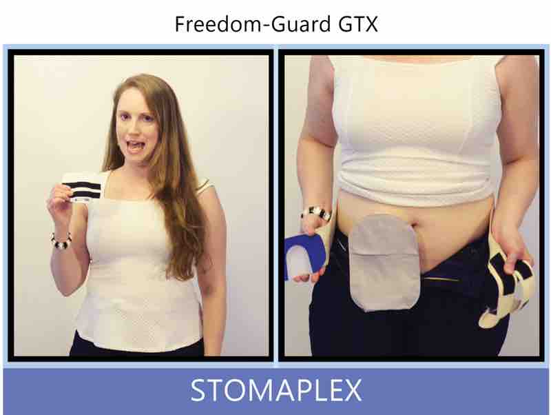 The stoma guard by Stomaplex is the answer. With this stoma guard, a women with an need for stoma protection will be confident that she will be able to resume an active life. By wearing the ostomy belt under her clothing her ostomy will be protected from contact.
To put the stoma guard on, she holds the guard in her right hand and the ostomy belt in her left. The belt is made a micro-fiber material that will feel dry to the skin even when it is wet from sweating during the hot summer days or from exercising. The Velcro on the inside of the belt secures itself to the stoma guard. Ostomy belt, ostomy, stoma, protection, stoma protection, stoma guard, ostomy guard, ostomy protection products, ostomy shower, ostomy leak, stoma leak, ostomy hernia, stoma hernia, ostomy sports, stoma sports, hernia, stoma belt, ostomy leaks, stoma leaks, leaking barrier, leaking stoma, stoma pain, ostomy pain, stomal hernias, hernias, children stoma, pediatric armor, ostomy protection, stoma protection sale, ostomy products, ostomy discounts, ostomy product discounts, ostomy product sale, ostomy ultimate discount package, strong ostomy belt, strongest ostomy belt, stoma shield, stoma shields, stoma guards, stoma protection products, stoma guard belt, stoma protection for sports, stoma protector, stoma guard reviews, stoma protectors, ostomy shower apron, ileostomy, colostomy, stomaplex, ostomy belt swimming, ostomy clothing, ostomy leak protection, freedom guard, comfort guard, veterans ostomy, pediatric ostomy belts, pediatric stoma, pediatric stoma protection, stoma protection for children, children ostomy belts