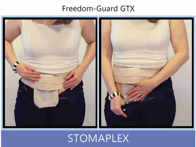 Ostomy belt, ostomy, stoma, protection, stoma protection, stoma guard, ostomy guard, ostomy protection products, ostomy shower, ostomy leak, stoma leak, ostomy hernia, stoma hernia, ostomy sports, stoma sports, hernia, stoma belt, ostomy leaks, stoma leaks, leaking barrier, leaking stoma, stoma pain, ostomy pain, stomal hernias, hernias, children stoma, pediatric armor, ostomy protection, stoma protection sale, ostomy products, ostomy discounts, ostomy product discounts, ostomy product sale, ostomy ultimate discount package, strong ostomy belt, strongest ostomy belt, stoma shield, stoma shields, stoma guards, stoma protection products, stoma guard belt, stoma protection for sports, stoma protector, stoma guard reviews, stoma protectors, ostomy shower apron, ileostomy, colostomy, stomaplex, ostomy belt swimming, ostomy clothing, ostomy leak protection, freedom guard, comfort guard, veterans ostomy, pediatric ostomy belts, pediatric stoma, pediatric stoma protection, stoma protection for children, children ostomy belts