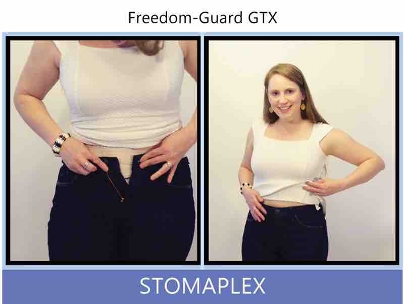 Here is my side profile to show how nice the stoma guard looks with jeans and a top. Get your ready to go out and live the active life you were before the ileostomy. The Stomaplex stoma guard works great with any type of ostomy: colostomy, ileosotmy, or urostomy. Protect yourself from seatbelts with the Stomaplex stoma guard. Ostomy belt, ostomy, stoma, protection, stoma protection, stoma guard, ostomy guard, ostomy protection products, ostomy shower, ostomy leak, stoma leak, ostomy hernia, stoma hernia, ostomy sports, stoma sports, hernia, stoma belt, ostomy leaks, stoma leaks, leaking barrier, leaking stoma, stoma pain, ostomy pain, stomal hernias, hernias, children stoma, pediatric armor, ostomy protection, stoma protection sale, ostomy products, ostomy discounts, ostomy product discounts, ostomy product sale, ostomy ultimate discount package, strong ostomy belt, strongest ostomy belt, stoma shield, stoma shields, stoma guards, stoma protection products, stoma guard belt, stoma protection for sports, stoma protector, stoma guard reviews, stoma protectors, ostomy shower apron, ileostomy, colostomy, stomaplex, ostomy belt swimming, ostomy clothing, ostomy leak protection, freedom guard, comfort guard, veterans ostomy, pediatric ostomy belts, pediatric stoma, pediatric stoma protection, stoma protection for children, children ostomy belts
