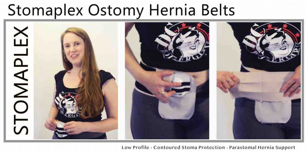 Stoma Guard Ostomy Belt Stomaplex