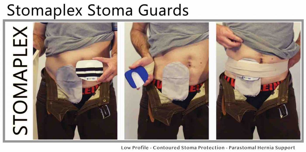 Stoma Guard Ostomy Belt Stomaplex