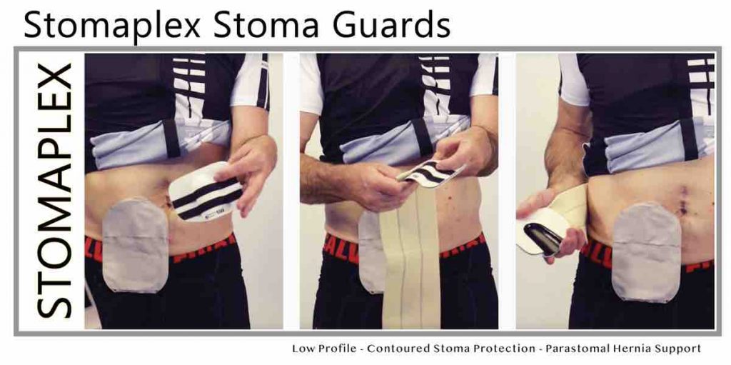 Stoma Guard Ostomy Belt Stomaplex