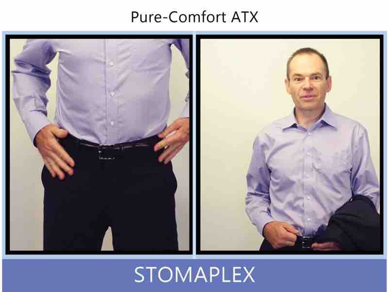 Finish getting dressed with an ostomy by tightenting the belt on your dress pants over your ostomy. It feels great to be able to wear a suit and tuck in your dress shirt into your suit pants with an ostomy as you head out to work in the office. Nobody will notice that you have an ostomy. The Stomaplex ostomy belt will allow you to have the lowest profile of any ostomy protection.
Give the stoma guard a rap to prove to yourself that your stoma is totally protected from contact. You'll feel completly confident to go about your daily job duties without even thinking that you will damage your ostomy Ostomy belt, ostomy, stoma, protection, stoma protection, stoma guard, ostomy guard, ostomy protection products, ostomy shower, ostomy leak, stoma leak, ostomy hernia, stoma hernia, ostomy sports, stoma sports, hernia, stoma belt, ostomy leaks, stoma leaks, leaking barrier, leaking stoma, stoma pain, ostomy pain, stomal hernias, hernias, children stoma, pediatric armor, ostomy protection, stoma protection sale, ostomy products, ostomy discounts, ostomy product discounts, ostomy product sale, ostomy ultimate discount package, strong ostomy belt, strongest ostomy belt, stoma shield, stoma shields, stoma guards, stoma protection products, stoma guard belt, stoma protection for sports, stoma protector, stoma guard reviews, stoma protectors, ostomy shower apron, ileostomy, colostomy, stomaplex, ostomy belt swimming, ostomy clothing, ostomy leak protection, freedom guard, comfort guard, veterans ostomy, pediatric ostomy belts, pediatric stoma, pediatric stoma protection, stoma protection for children, children ostomy belts