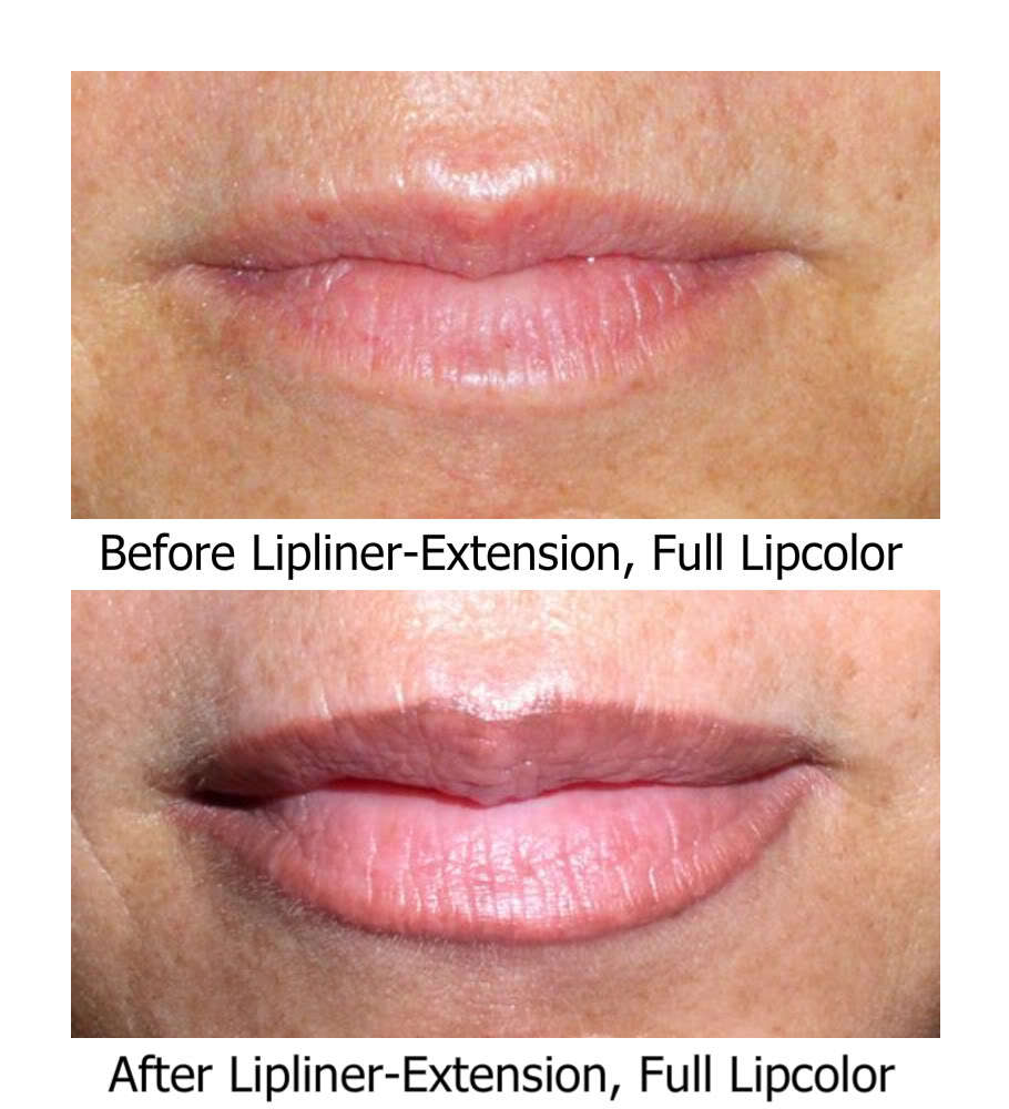 SofTap Lipliner/Full lipcolor Needles