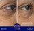 The Eye Cream Complete Set