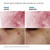 Phyto Corrective Serum