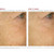 Intense Stem Cell Booster Serum