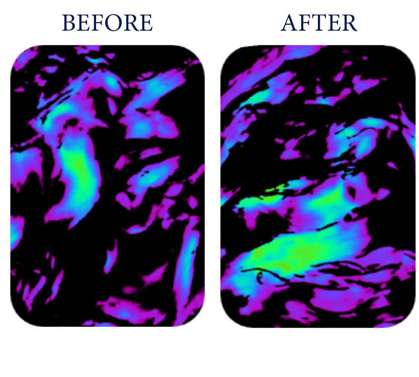Before and After collagen graphs from an in-vivo test.