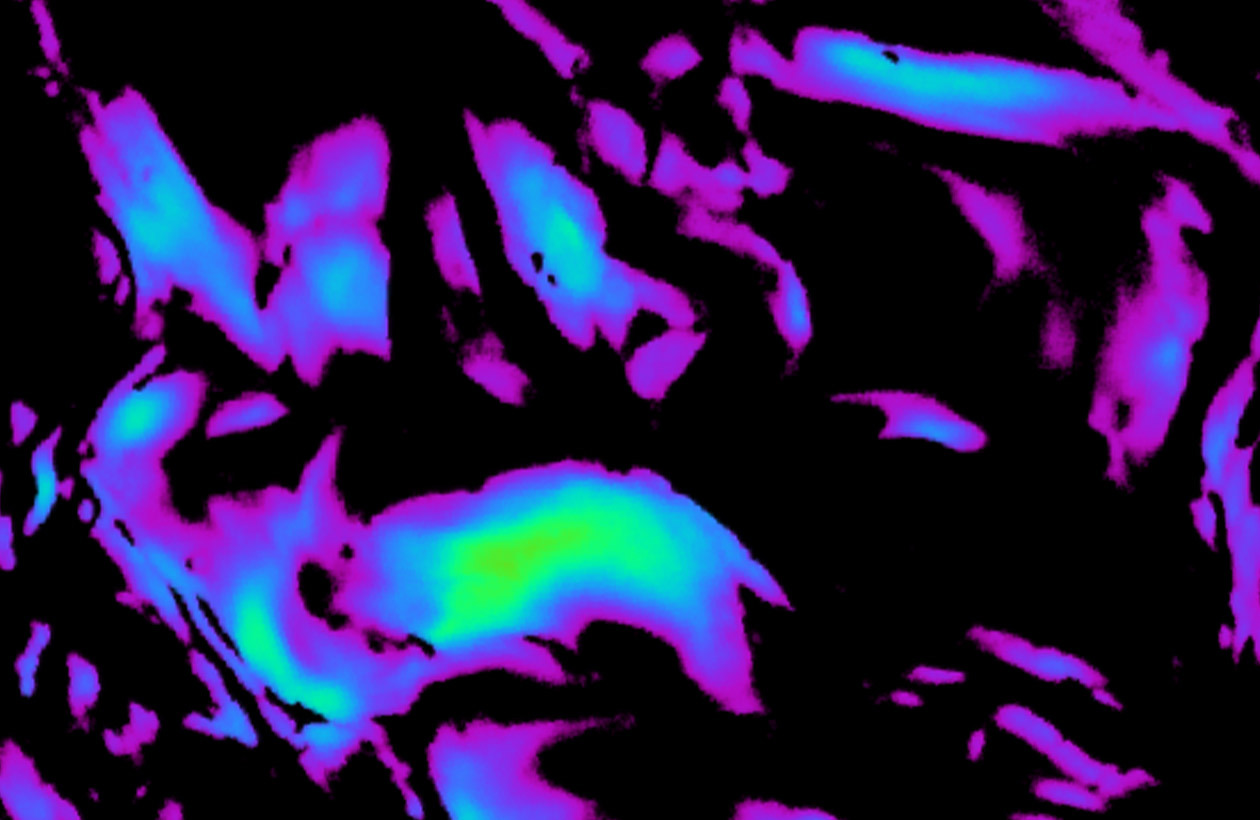 Before using Perles Des Mers there were less collagen fibers in the skin.