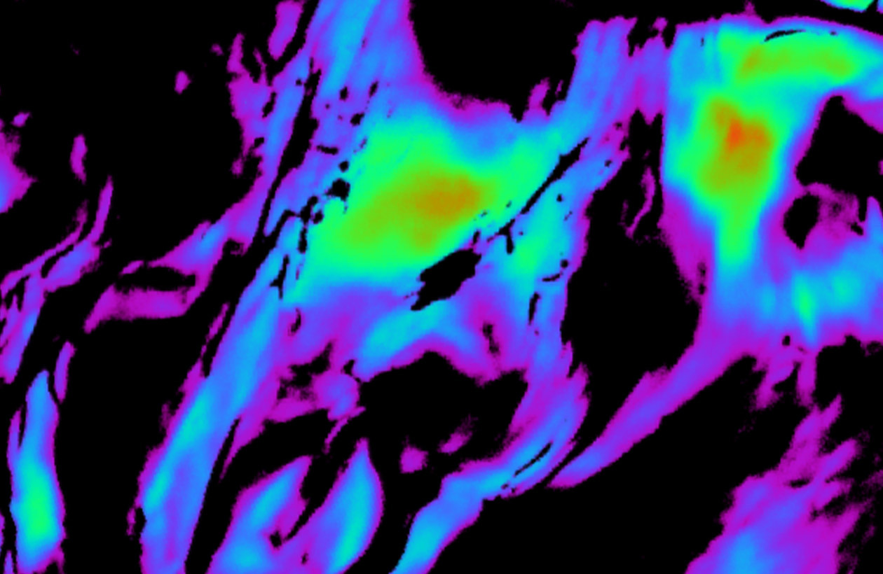 After using Perles Des Mers there was more collagen fibers in the skin.