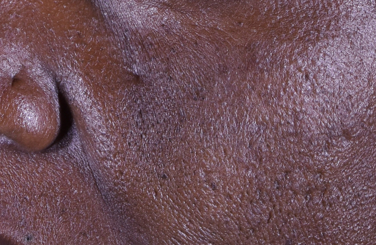 Before using perles des mers, this persons skin had rougher and dull skin.