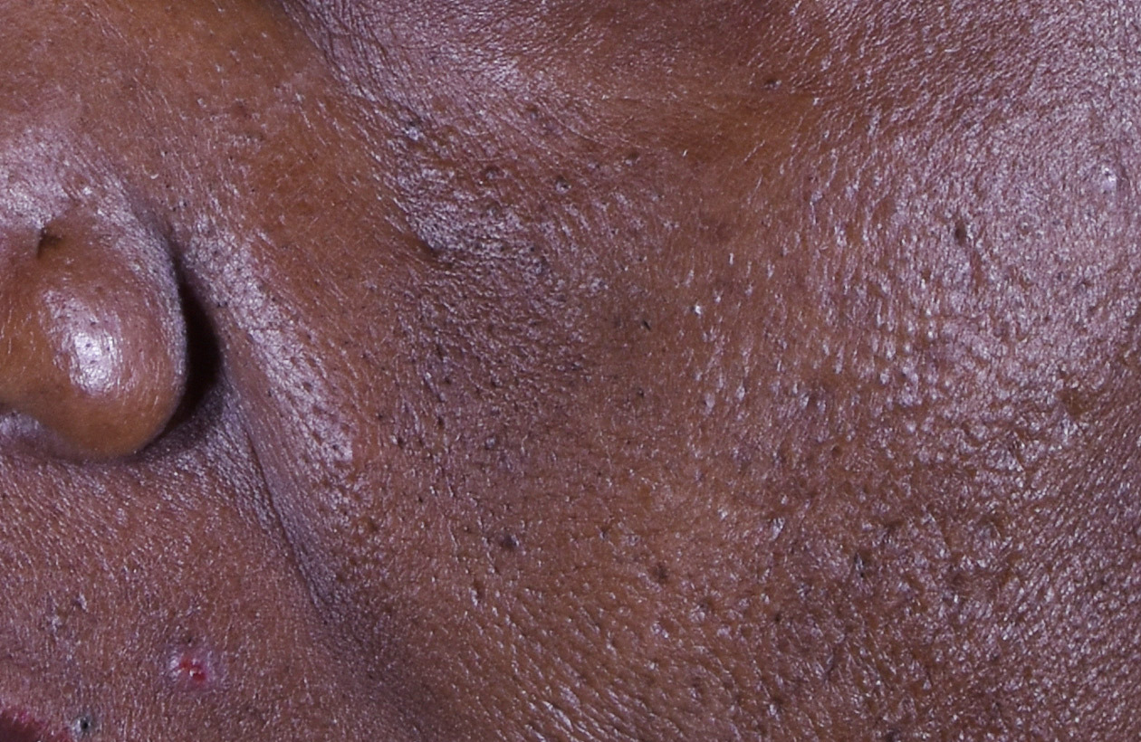 After using perles des mers, this persons skin had smoother and more radiant kin.