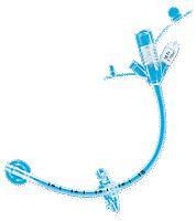 Avanos - BLD 010018 - EA/1 MIC GASTROSTOMY TUBE, ADULT 18FR 7-10CC
