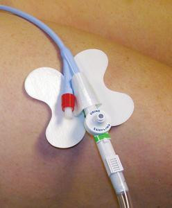 M.C. Johnson - MCJ 54456 - EA/1 CATH-SECURE MULTI-PURPOSE TUBE HOLDER 2 1/2IN WRAP TAB, BUTTERFLY BASE
