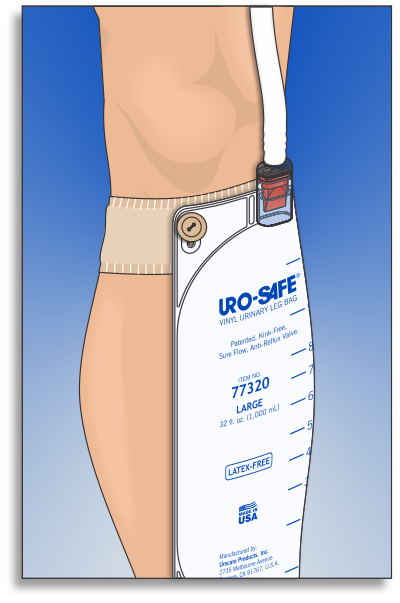 Urocare - URO 6360 - PKG/2 UNIVERSAL FABRIC LEG BAG STRAP KIT SMALL