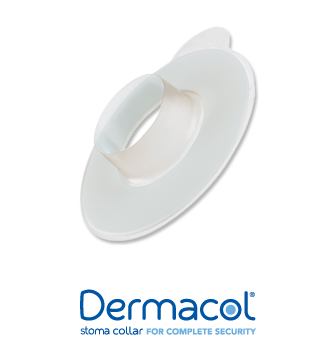 Salts Healthcare - SALT DC35 - BX/30 DERMACOL STOMA COLLAR, FITS STOMA SIZE 33MM - 35MM