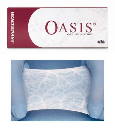 Smith & Nephew - SNU 8213601072 - BX/5 OASIS WOUND MATRIX FENESTRATED, 7CM X 20CM (NON-RETURNABLE)