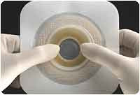 Convatec - SQU 421033 - BX/10 NATURA MOLDABLE STOMAHESIVE, FLANGE 2 1/4IN (57MM), CUT-TO-FIT 1/2IN (13MM) - 7/8IN (22MM)